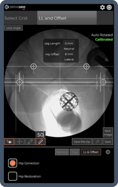 digital orthopedic surgery